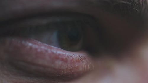 Junger Mann blinzelnde Augen