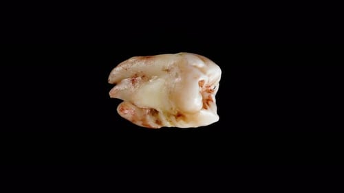 Top view of a extracted tooth in blood cyclically rotating on an isolated black background. Macro.