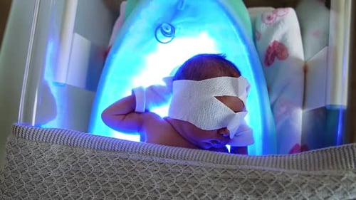 Bebê recém-nascido de três dias com cobertura ocular e luvas está na incubadora médica.