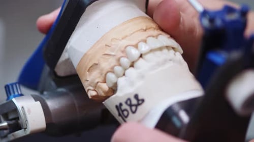 Close Up Man Dentist Hands Setting Dental Tooth Crown on Jaw Model Working on Dentures Orthodontic