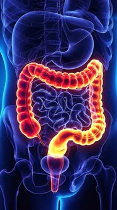 Diarrhea - Intestinal Inflammation Thermal Activity Map 3D Animation | Manestream Den