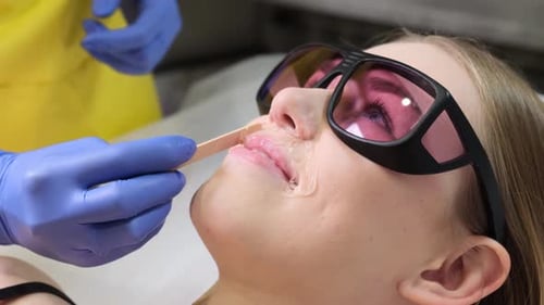 Ein Arzt in Handschuhen entfernt einer Frau mit einem modernen Laser Gesichtsbehaarung