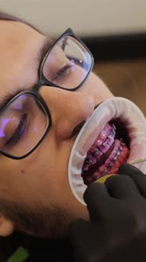 Orthodontist Adjusting Braces on a Patient's Teeth