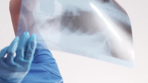 Vertical Medical Diagnostics Chest Xray Doctor
