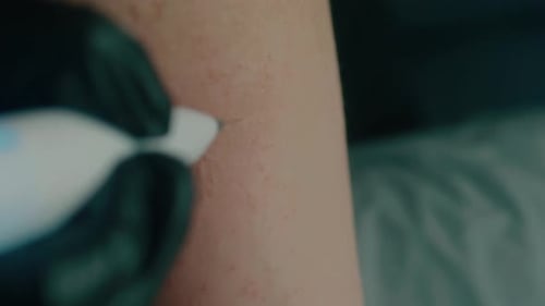 Cosmetic Procedure on Arm, Close Up