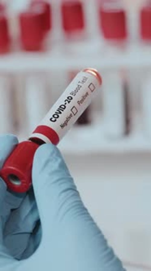 Marking COVID Blood Test Positive