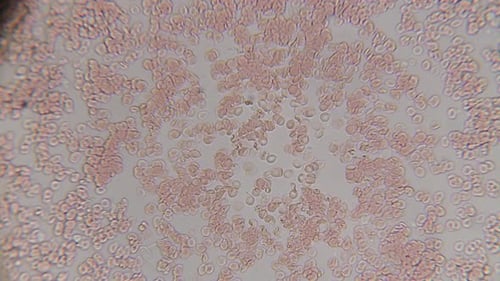 Fresh blood seen on a 400x microscope view. Blood smear under microscope present plasma