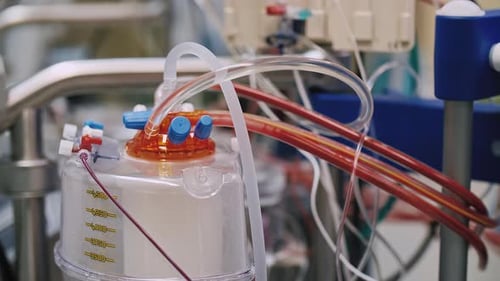 Heart Lung Machine in Hospital Operating Room