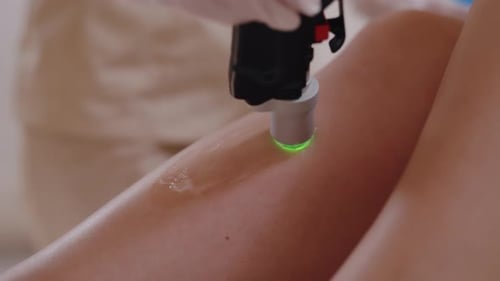 Woman Getting Laser Hair Removal Treatment on Leg
