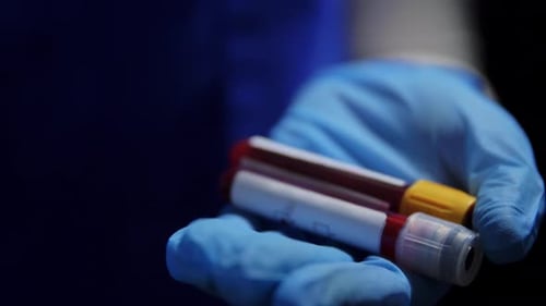 Medicine, Healthcare and Virus Concept - Close Up of Hand in Protective