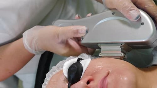 Facial Laser Treatment for Skin Rejuvenation