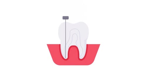 Root Canal Element Alpha Animation