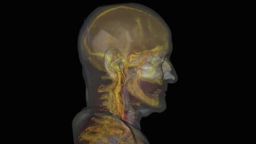 Rotating 3D Human Anatomical Scan of Skull and Vascular System
