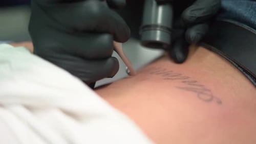 Woman remove tattoo, deleting or erasing. Dermatologist clinic tatto erase professionaly.
