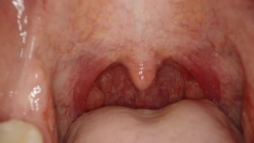 Camera probe inside the mouth, medical examination. Tongue close-up.