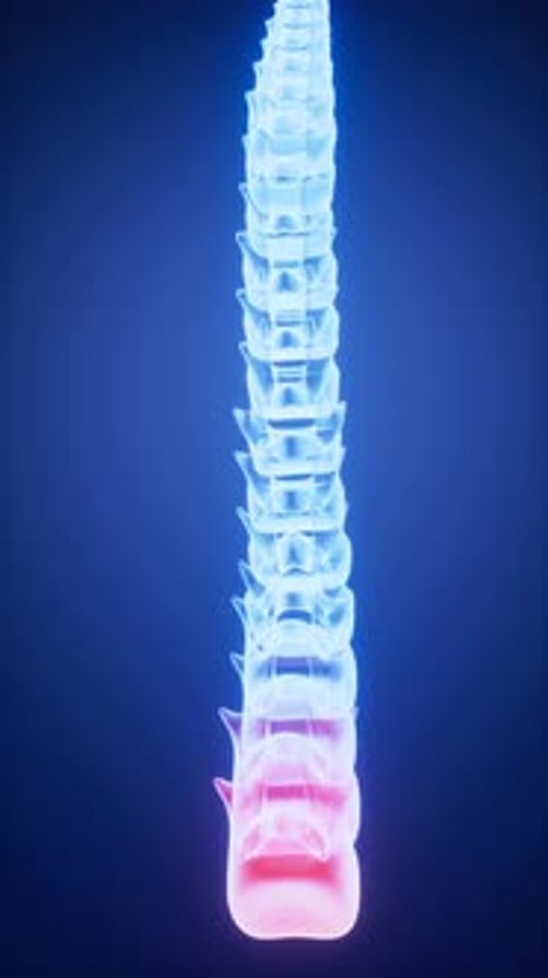 Inflammation of the human spine and drug therapy, medical concept, 3d rendering.