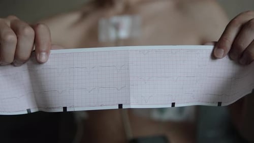 Kardiogramm-Grafik auf Papier in Hands of Man mit Holter-EKG-Monitor und Sensoren