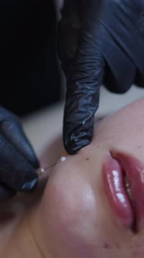 Doctors Hands Injecting Needle Into Patients Face