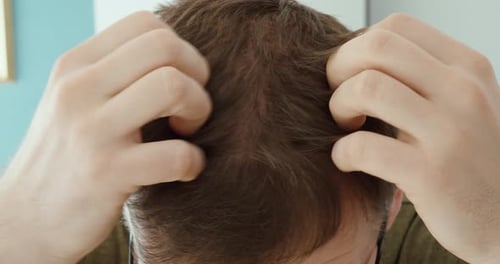 Man Scratches Scalp in Close Up Indoor Shot