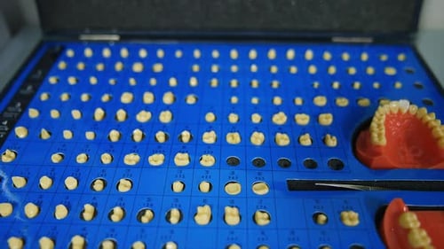 A set of teeth samples and two denture models. Close up. Dentistry and implantation concept.