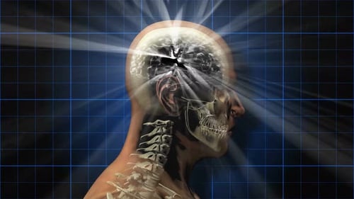 Animated Medical Scan of Human Head With Glowing Brain Activity