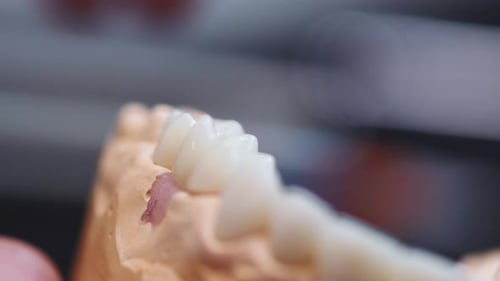 Dental Implants Crafting Process Extreme Close Up