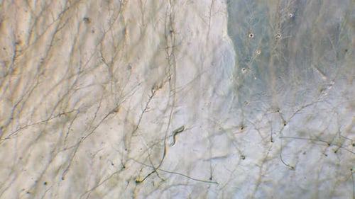 Nematode in Petri dish
