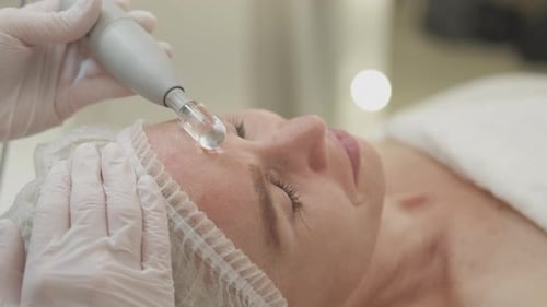 Facial Microdermabrasion Treatment at Health Facility