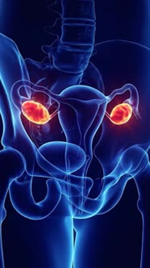 Pcos - Ovarian Metabolic Activity Thermal Map 3D Animation | Manestream Den