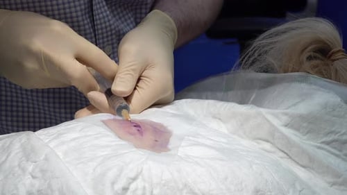 Doctor Using Local Anaesthetic Before the Surgery