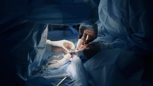 Surgeons Perform Operation in Hospital Operating Room