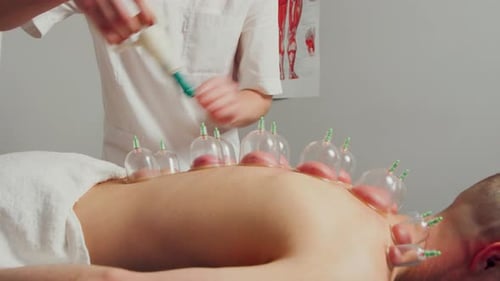 Cupping Therapy Session in a Modern Medical Office
