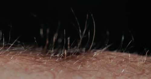 Small Hairs on a Man's Skin Rise Up Due to Intense Stress or Emotions
