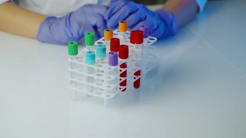 Medical Professional Removes Test Tube in Laboratory