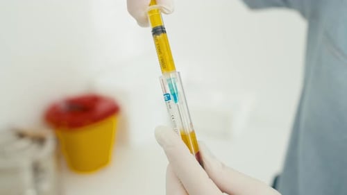 Medical Professional Extracts Fluid with Syringe from Sample