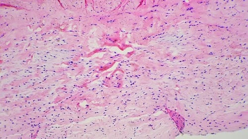 Dense Connective Tissue in Longitudinal Section Under Microscope 100x Against Bright Field