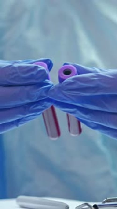 Scientist Holding Blood Vials in Medical Lab