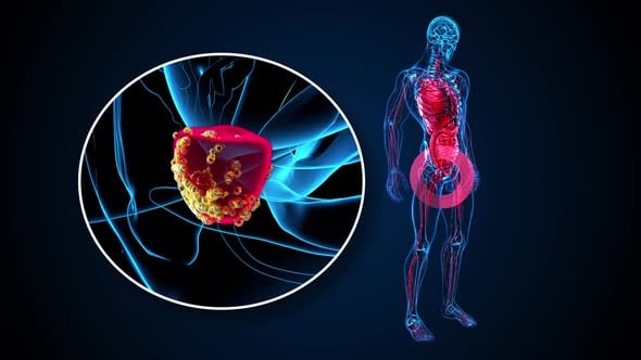 4K abstract 3D animation of the prostate cancer, Backgrounds Motion ...