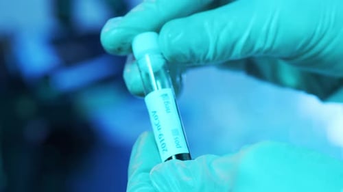 Laboratory Tubes with Blood and Virus Closeup of Scientific Lab in Hospital Epidemic Disease