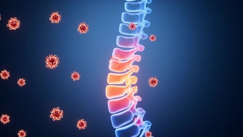 Human spine inflammation and viral infection, 3d rendering.