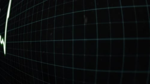 Animated Heartbeat ECG Line on Digital Monitor