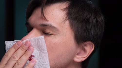 Man Wiping Blood From Nosebleed with Tissue Paper