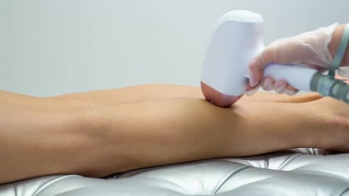 Laser Hair Removal on a Woman's Lower Leg