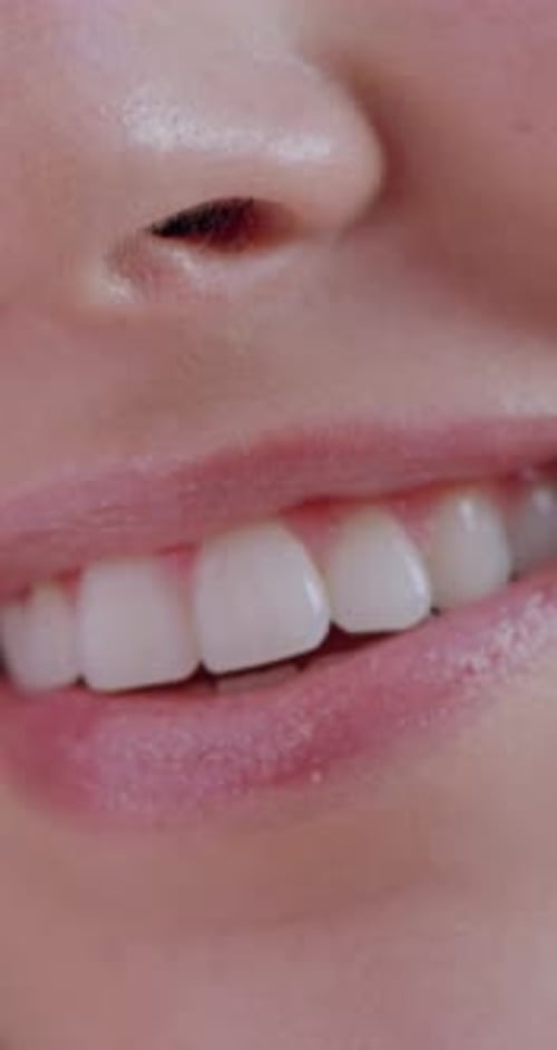 Close Up of Woman's Smile and White Teeth