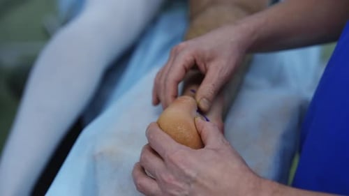 Surgeon's hands inspecting patient's leg. Doctor preparing leg before the operation.