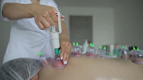Woman Receives Cupping Therapy on Her Back