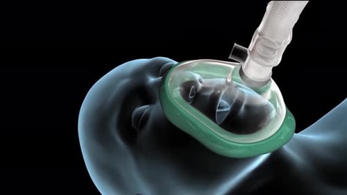 Profesional médico que usa una máscara de oxígeno en un paciente en emergencia