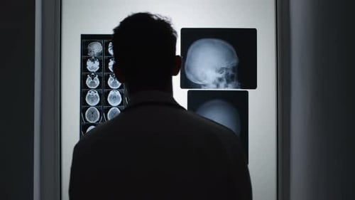 Silhouette eines Arztes, der Röntgenbilder von Gehirn und Schädel analysiert