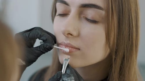 Woman Receiving Lip Augmentation Preparation