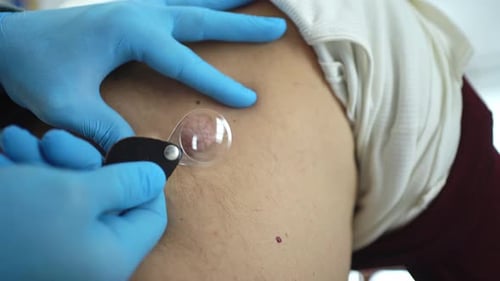 Procédure d'ablation de la peau en milieu clinique avec examen rapproché